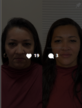 Antes e depois — viço e firmeza